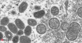 ‘Strange’ bleeding disease akin to Ebola kills 3 in Tanzania, Health News, ET HealthWorld