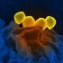 Environmental noise during night-time carries negative effect on sleep