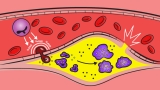 New immune target to treat cardiovascular disease discovered