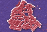 E. coli outbreak that caused falafel recall and made 1 Kansas resident ill, declared over by CDC