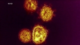 Delta variant as transmissible as chickenpox, KIRO 7 asks the experts what that means – KIRO 7 News Seattle