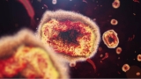 Georgia has the fifth most monkeypox cases of states in the U.S., according to latest CDC data – WSB-TV Channel 2