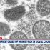 Health News | Researchers in US Developing Fast, Efficient COVID-19 Biosensor