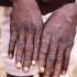CDC Recommends Indoor Masking in Polk as Infections Rise
