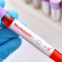 Ottawa County reported 64 additional COVID-19 cases this week