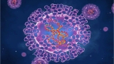 CDC investigating first suspected case of monkeypox in Georgia – WSB-TV Channel 2