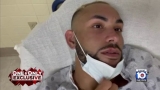 Miami man diagnosed with monkeypox says skin feels like it’s on fire