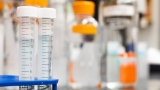 Marburg virus: WHO declares Ghana outbreak
