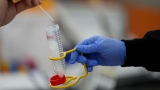 WHO sounds the alarm: New COVID variant is most transmissible yet