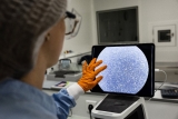 Dressing ‘revolution’ seeks artificial skin for burn victims