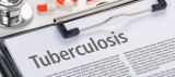 CDC reports sharp decline in TB diagnoses during pandemic