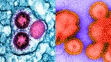 Flu season could be rough this year : Shots