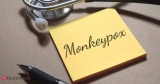 US warns monkeypox could mutate to resist antiviral drug, Health News, ET HealthWorld