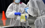 Mayo Clinic, CDC address concerns over monkeypox in the US