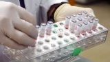 Virginia adds 5 monkeypox cases to statewide count