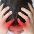 Colorado teen’s long COVID isn’t just persisting, it’s getting worse