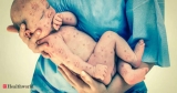 Zimbabwe says measles outbreak has killed 700 children, Health News, ET HealthWorld
